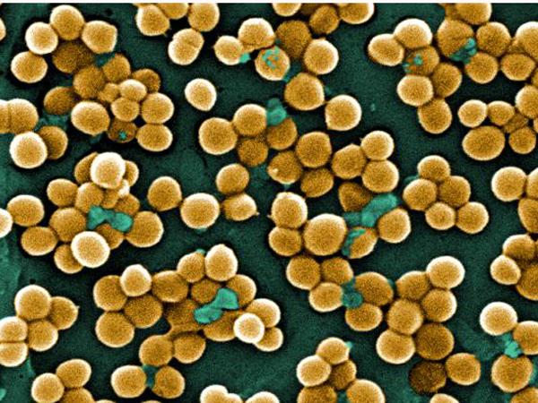 Staphylococcus aureus bacteria, MRSA